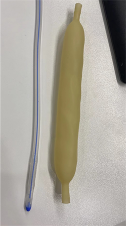 醫(yī)用胃管粘接案例